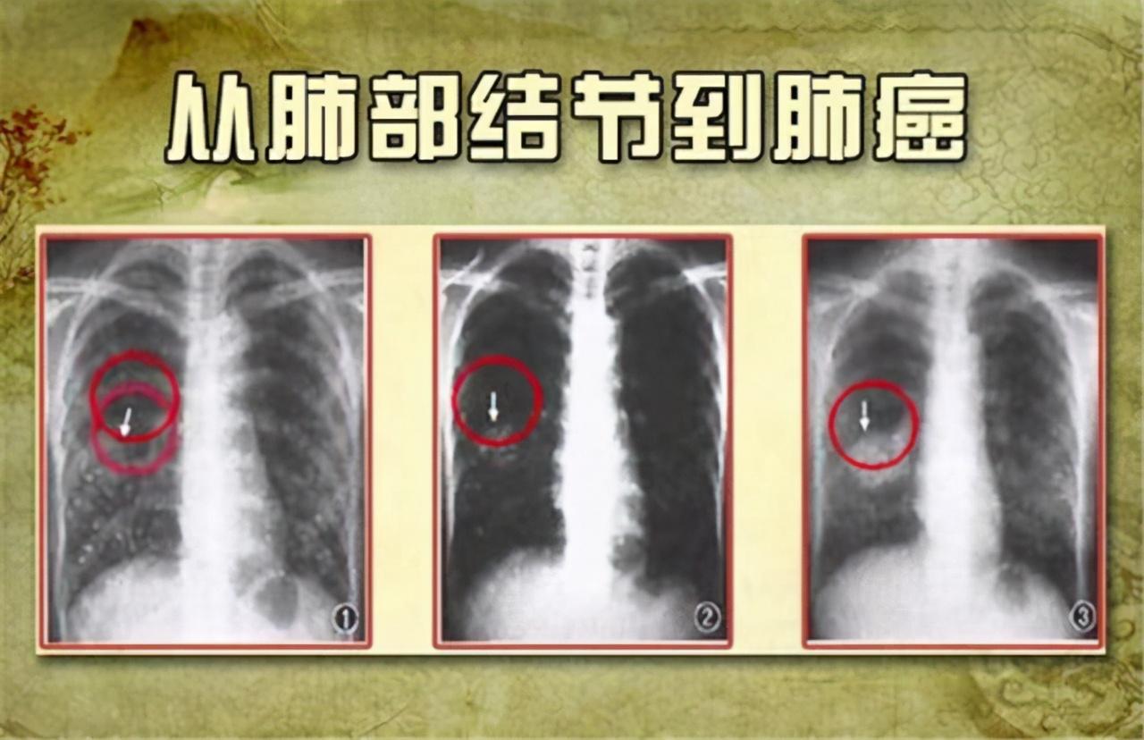 7777788888管家婆四肖八码99期既118开奖站一一澳门，详细解答、详细解答解释落实